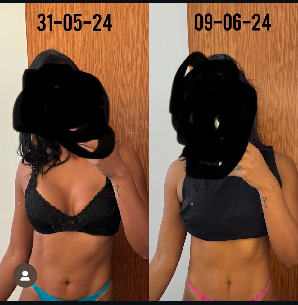 Comparativo abdominal com datas registradas